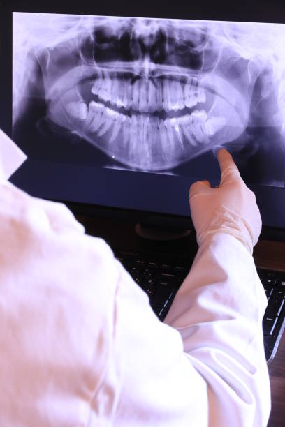 Best Emergency Dental Extractions in Fanning Springs, FL