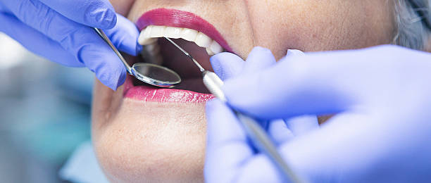 Best Emergency Dentist for Knocked-Out Tooth in Fanning Springs, FL
